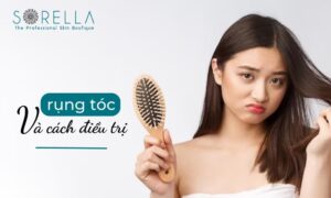 nguyên nhân và cách điều trị rụng tóc