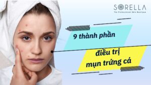 trị mụn trứng cá