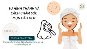 mụn đầu đen
