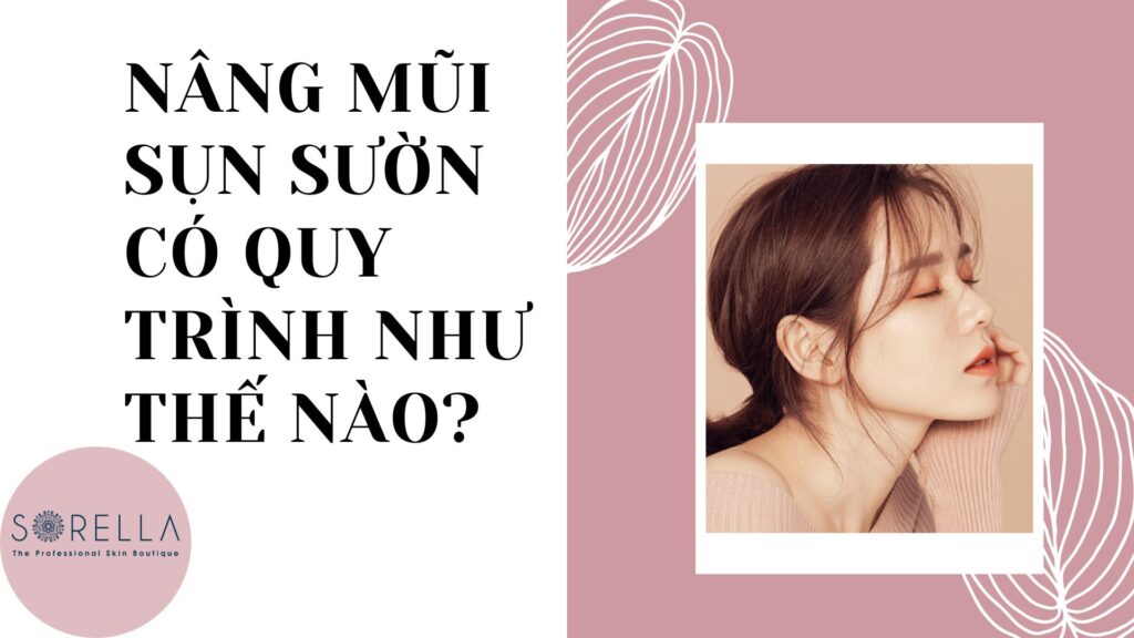 Nâng mũi sụn sườn có quy trình như thế nào?