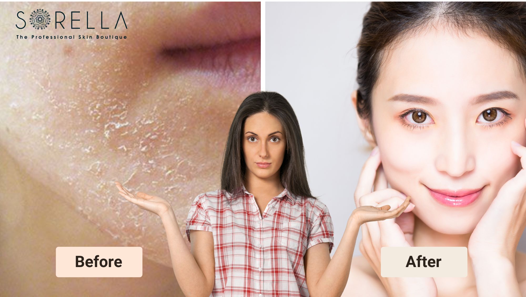 Tác hại của rượu thuốc trị mụn cần phải biết