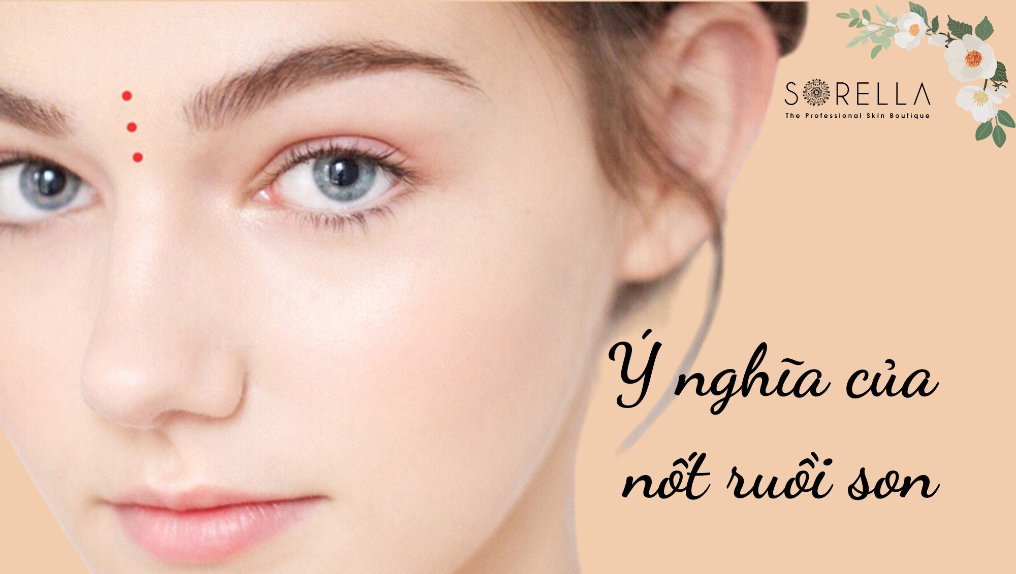 Ý nghĩa của nốt ruồi son