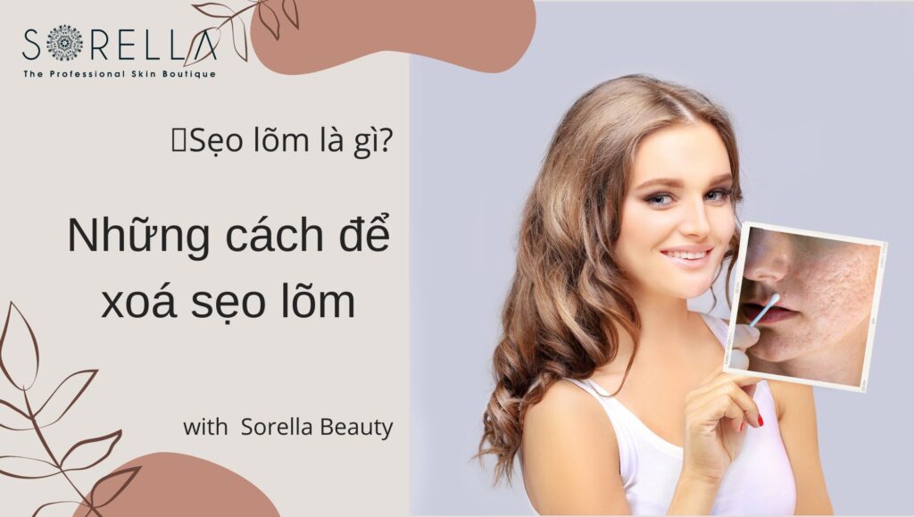 sẹo lõm