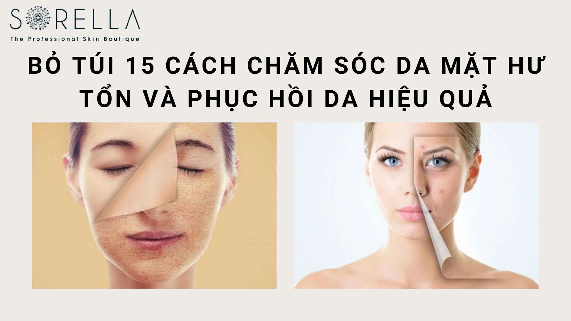 Bỏ túi 15 cách chăm sóc da mặt hư tổn và phục hồi da hiệu quả
