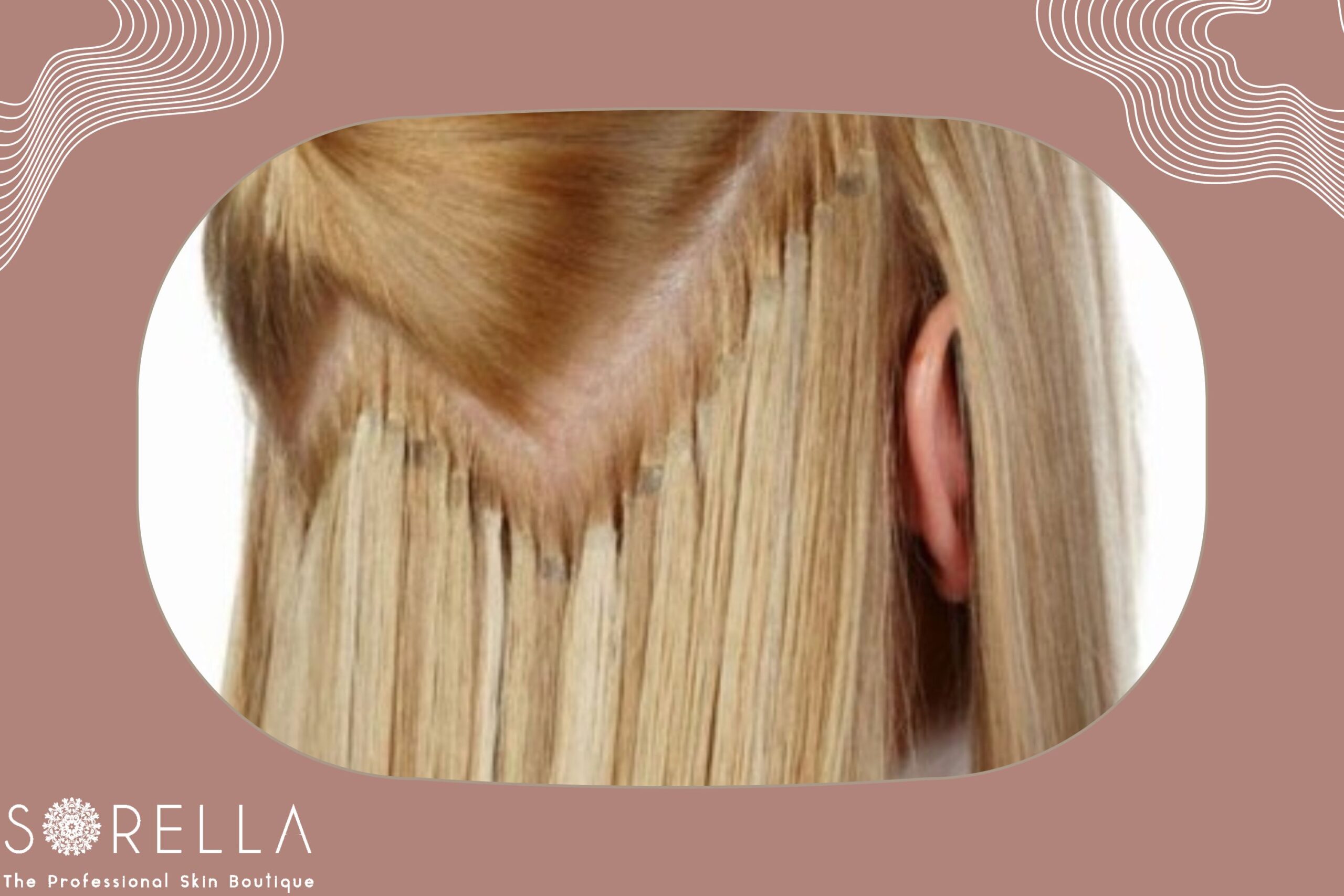 https://sorellafaceliftstudio.com/?p=7986&preview=true