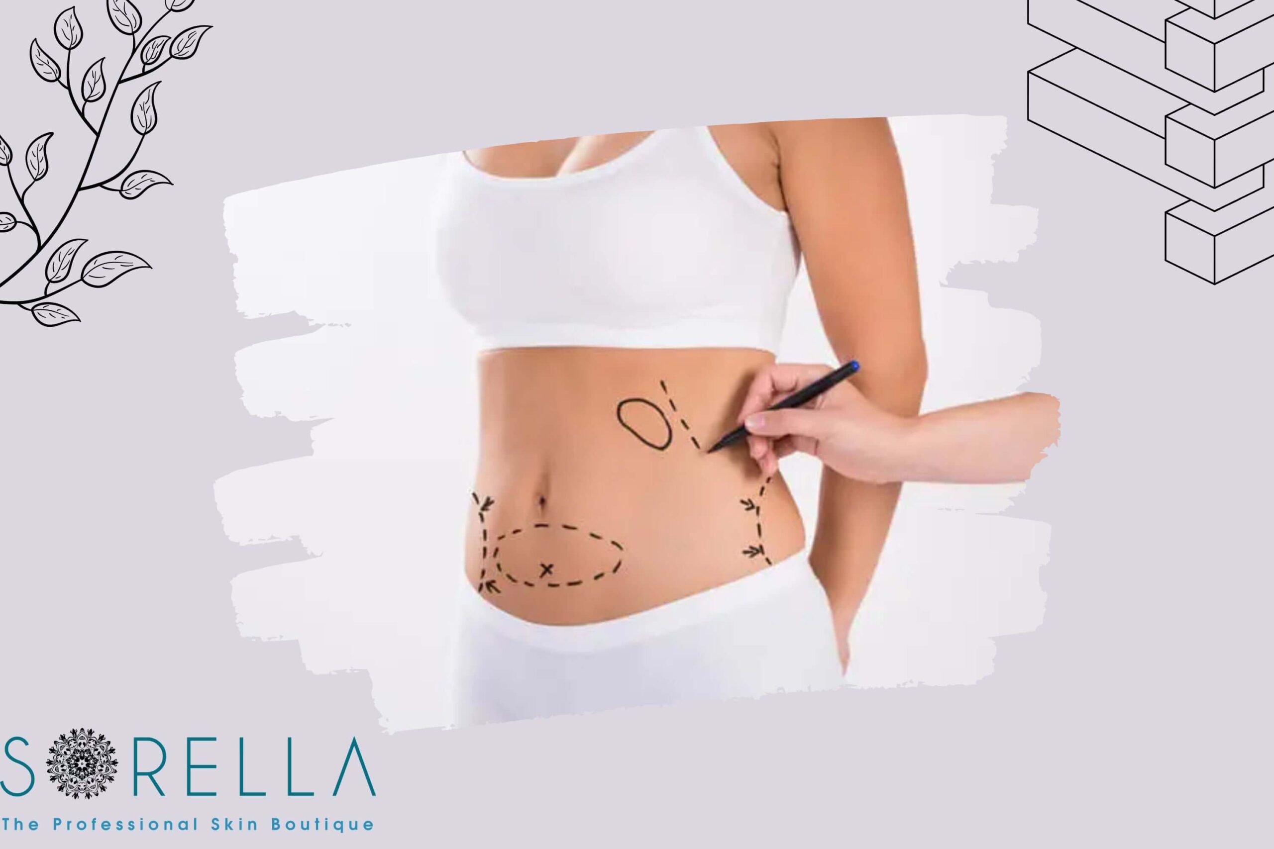 https://sorellafaceliftstudio.com/hut-mo-bung-va-6-dieu-can-luu-y.html hút mỡ bụng