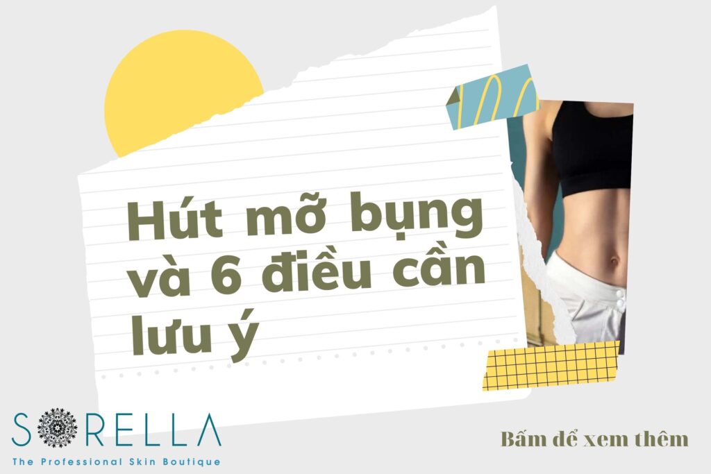 https://sorellafaceliftstudio.com/hut-mo-bung-va-6-dieu-can-luu-y.html