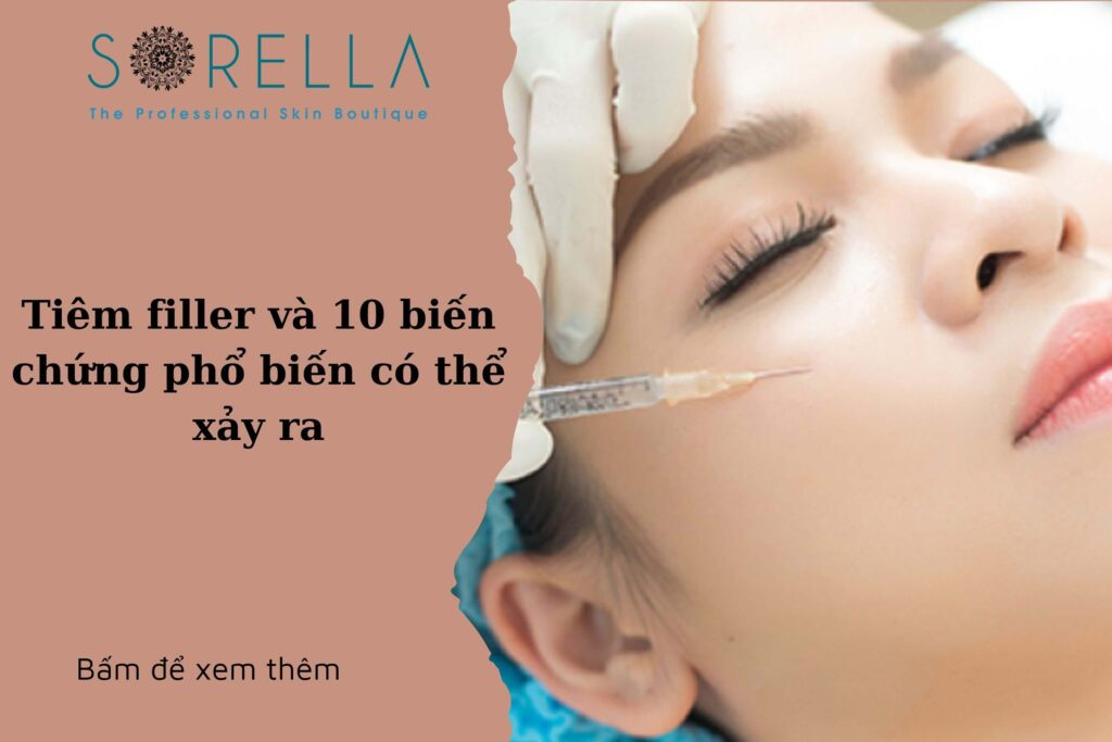 Tiêm fillerhttps://sorellafaceliftstudio.com/?p=8772&preview=true
