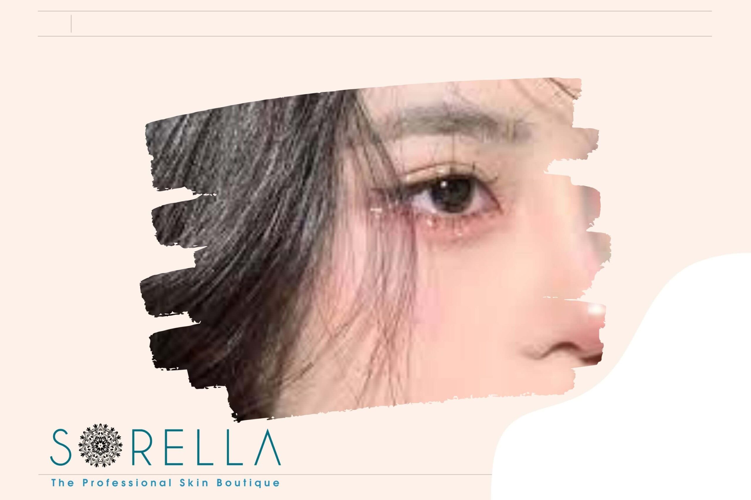 https://sorellafaceliftstudio.com/?p=9932&preview=true