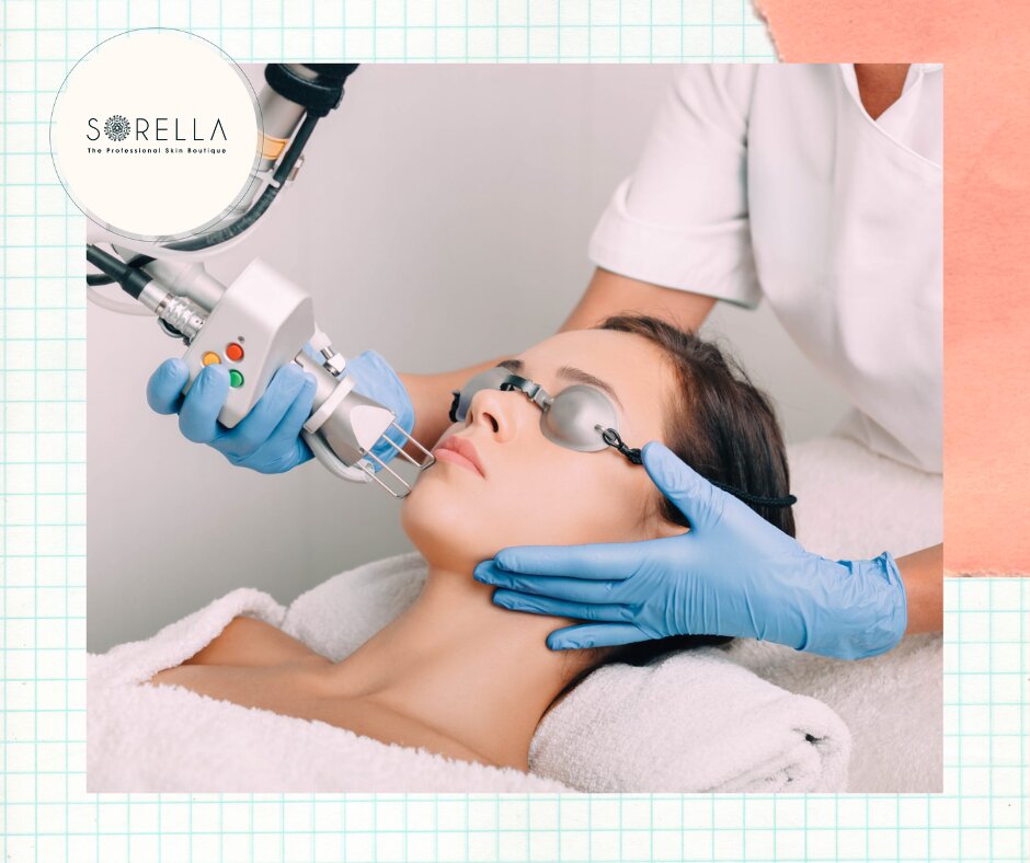 Laser skin resurfacing