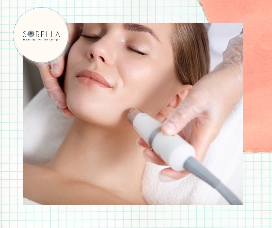 Laser skin resurfacing