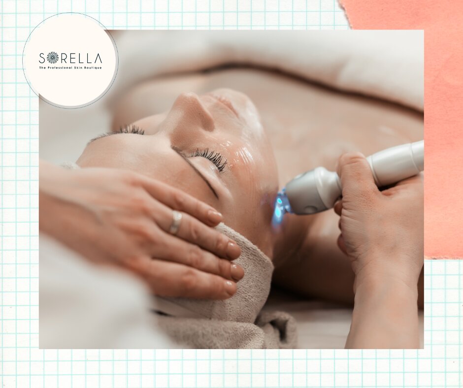 Laser skin resurfacing