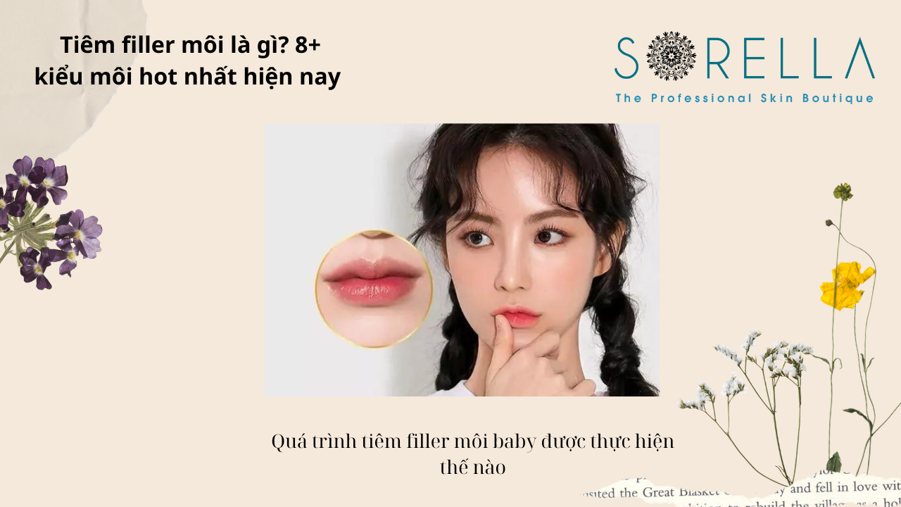 Có nên tiêm filler môi không? 