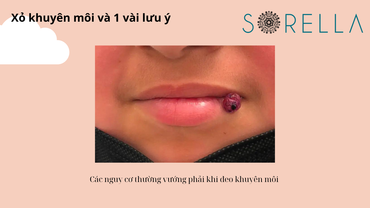 Xỏ khuyên môi và 1 vài lưu ý