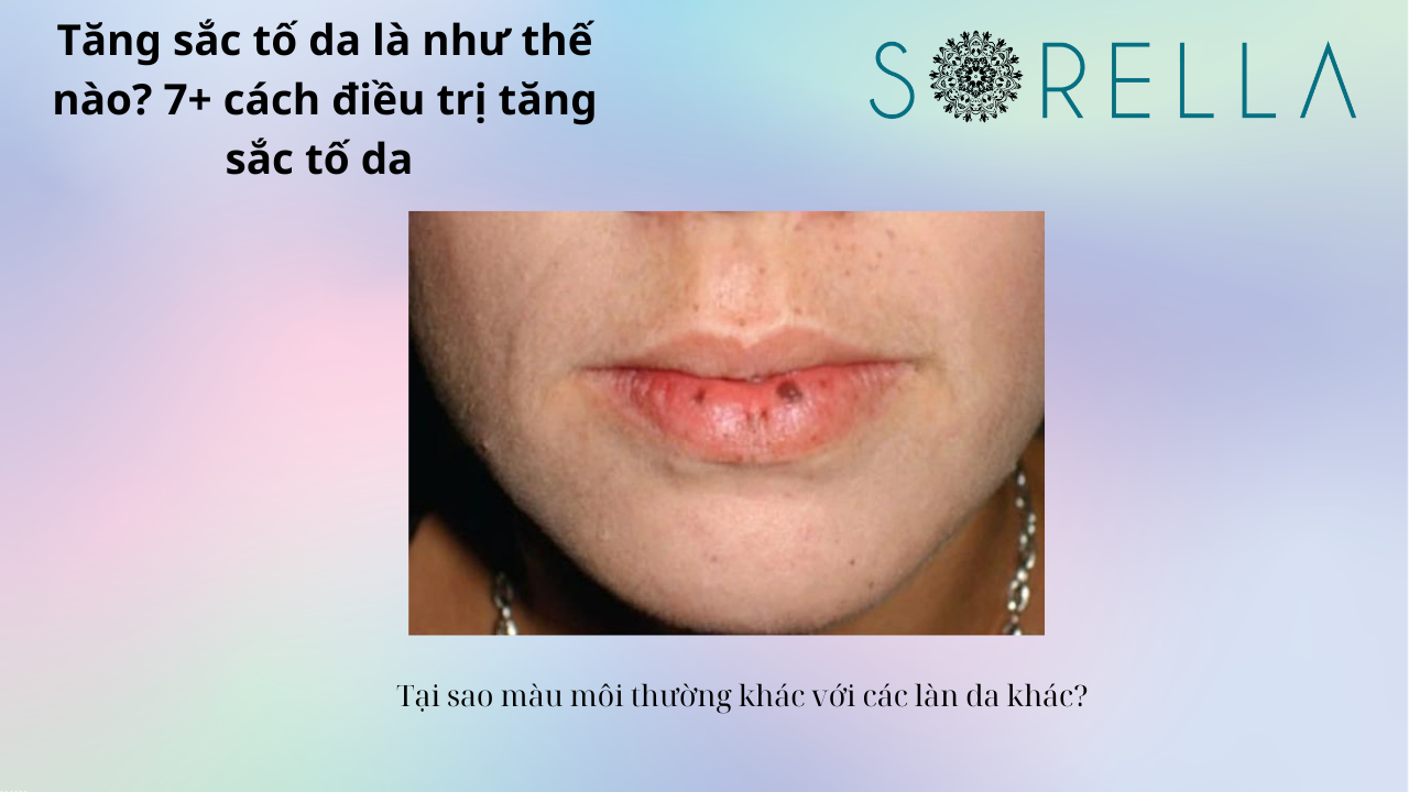 Tăng sắc tố da là như thế nào?