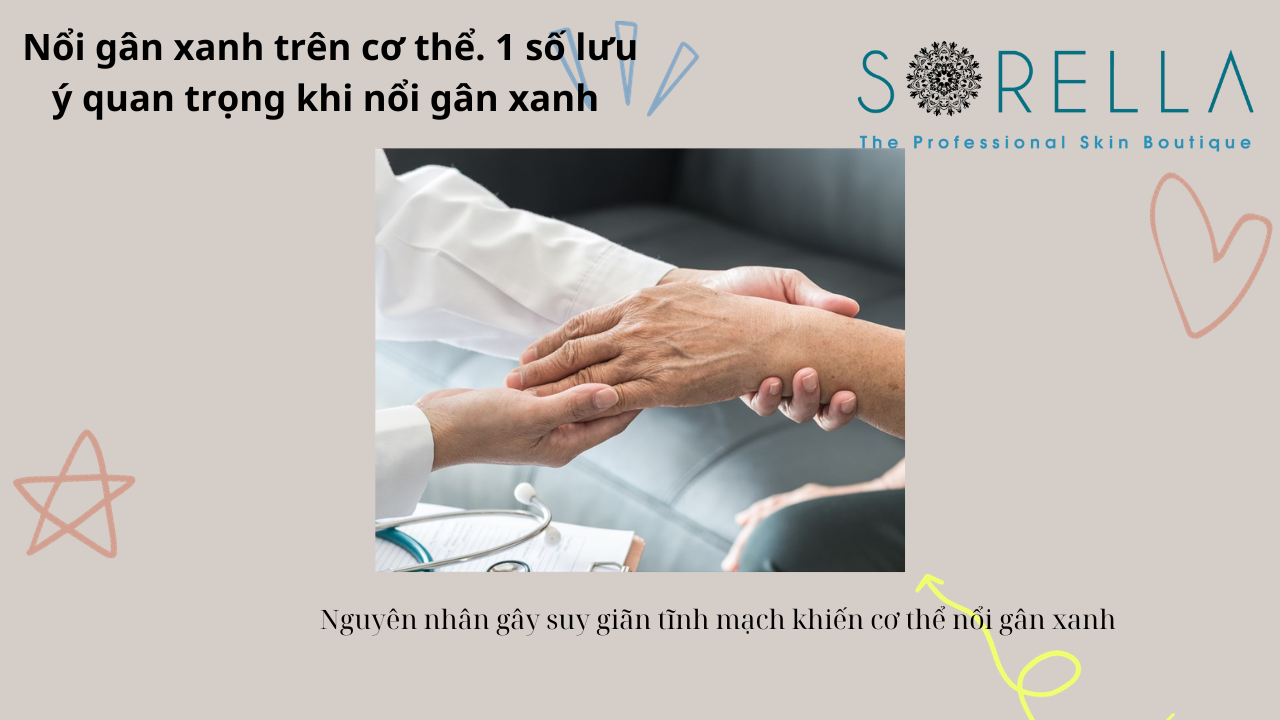 Nổi gân xanh trên cơ thể 