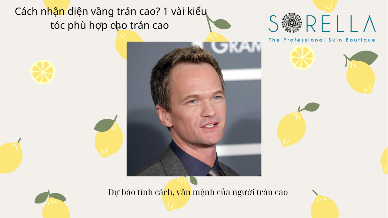 Cách nhận diện vầng trán cao?