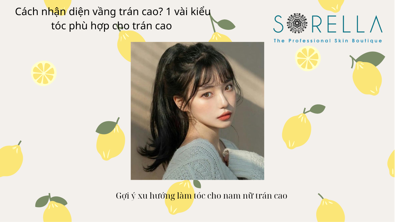 Cách nhận diện vầng trán cao?