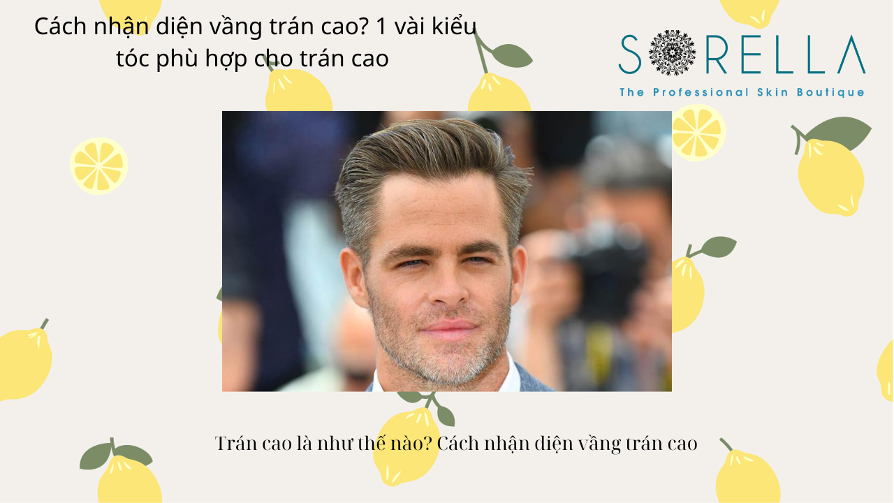 Cách nhận diện vầng trán cao?