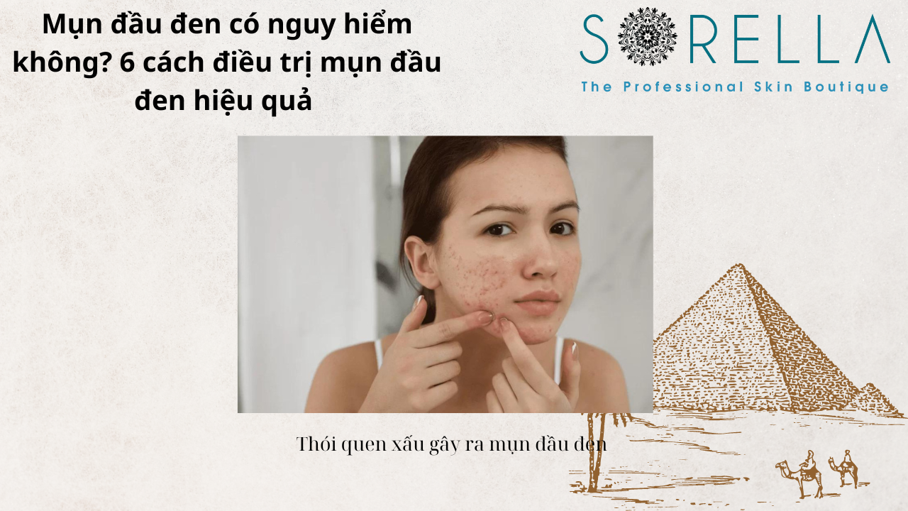 Mụn đầu đen có nguy hiểm không?