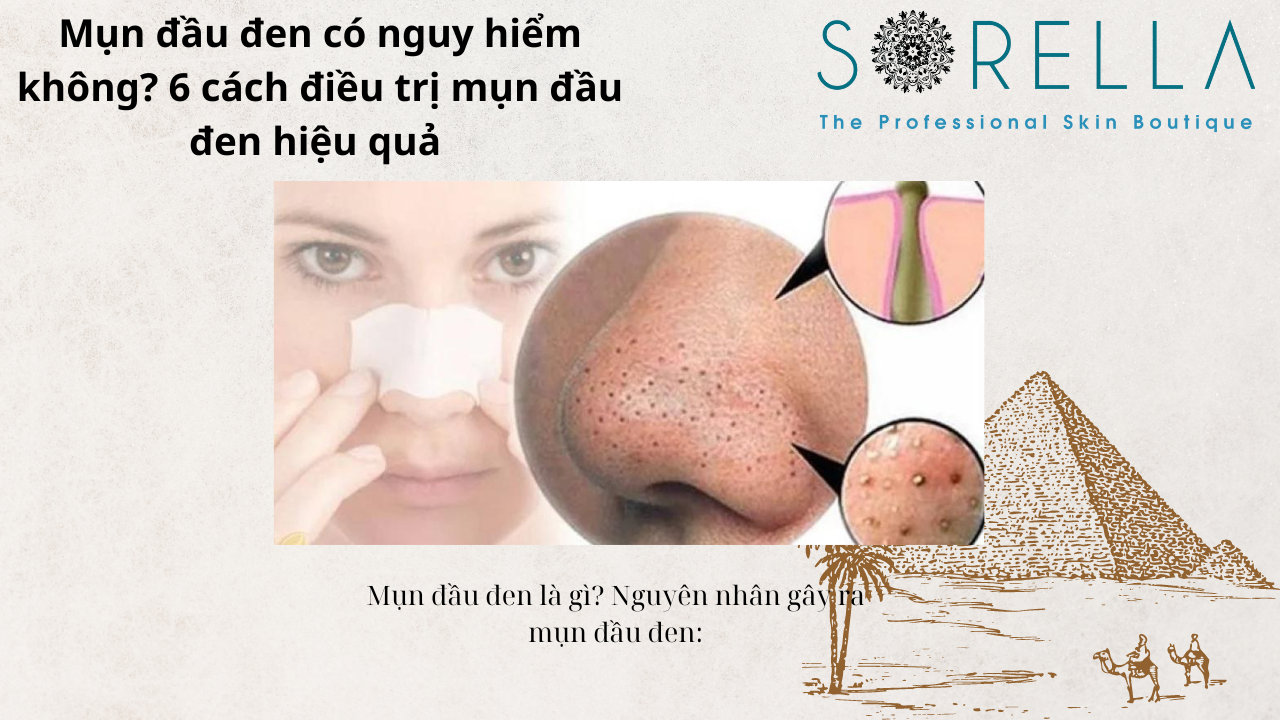 Mụn đầu đen có nguy hiểm không?