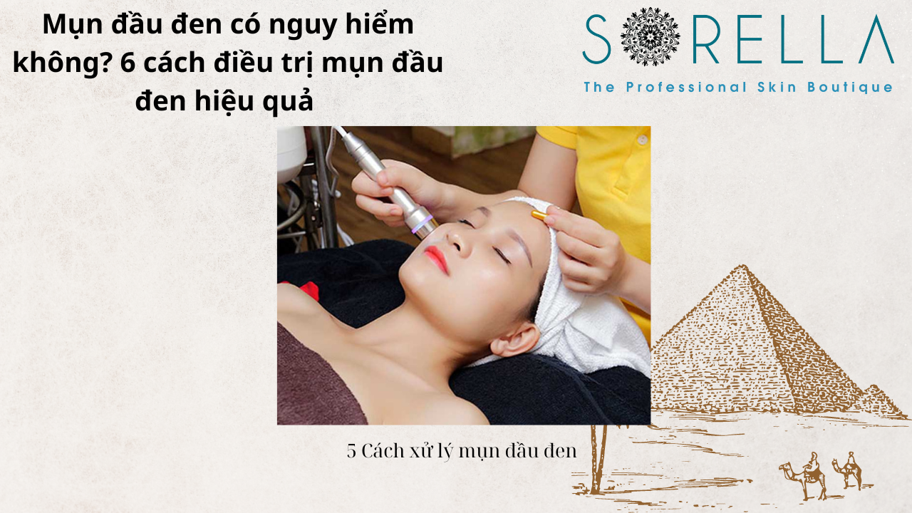Mụn đầu đen có nguy hiểm không?