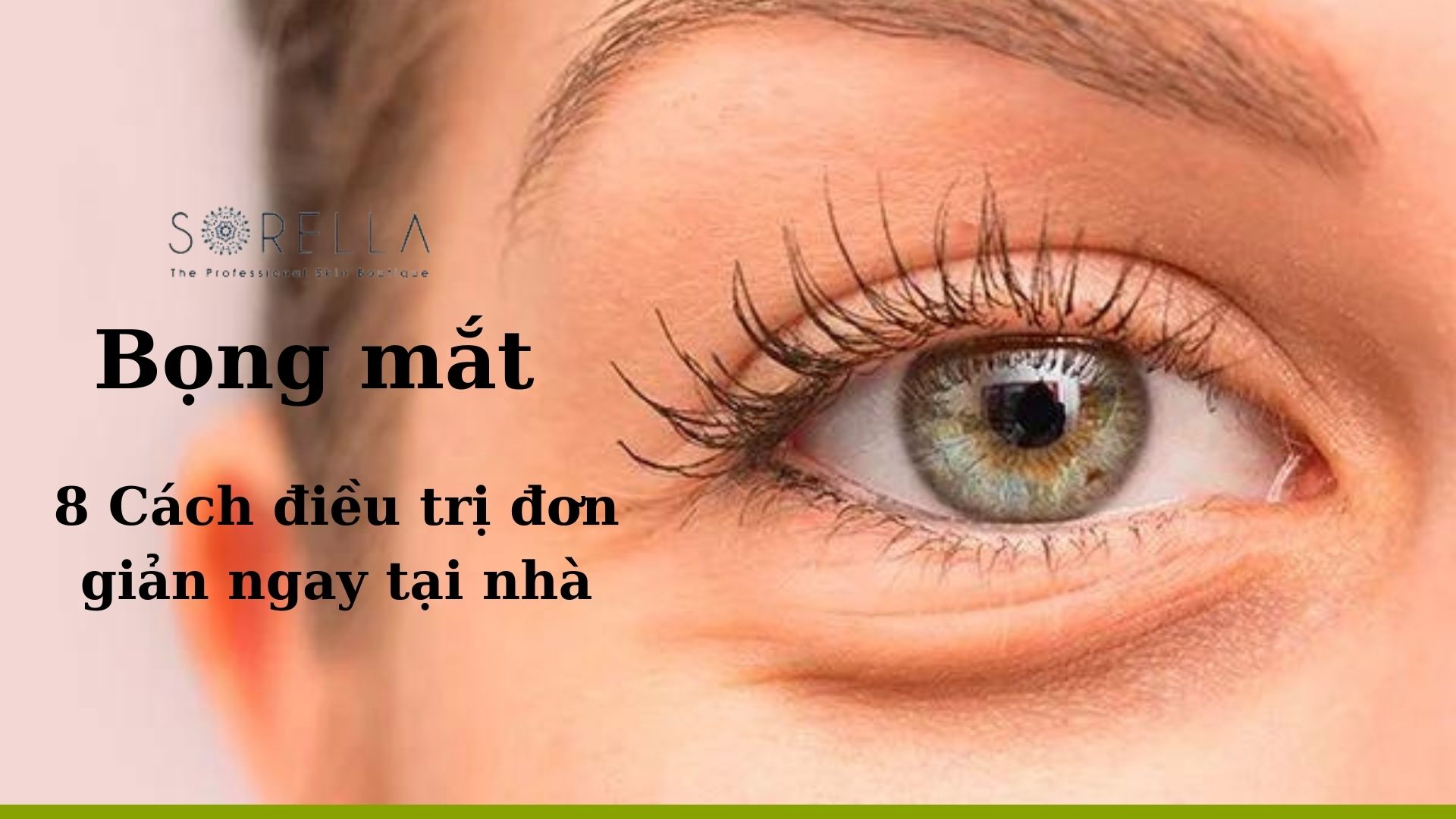Bọng mặt và 8 cách điều trị đơn giản và hiệu quả