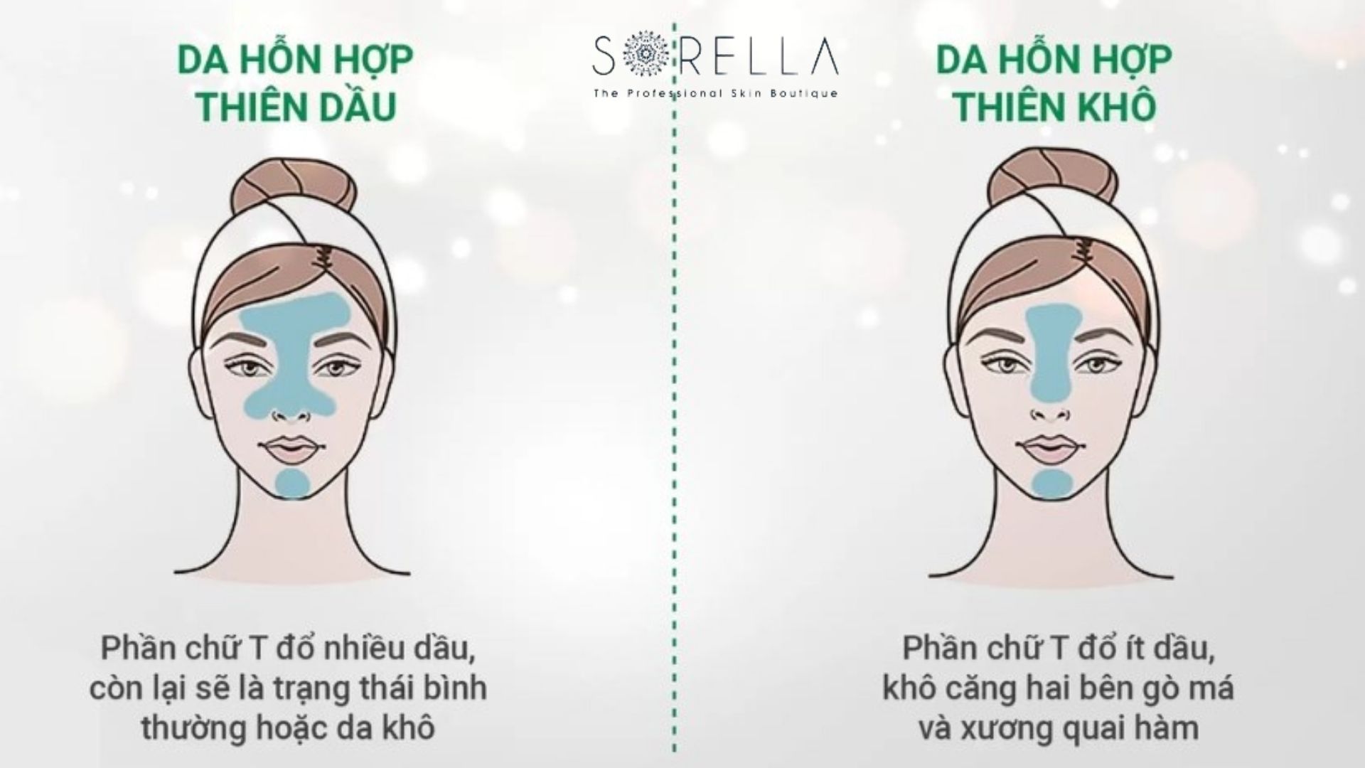 8 cách chăm sóc da hỗn hợp tốt nhất