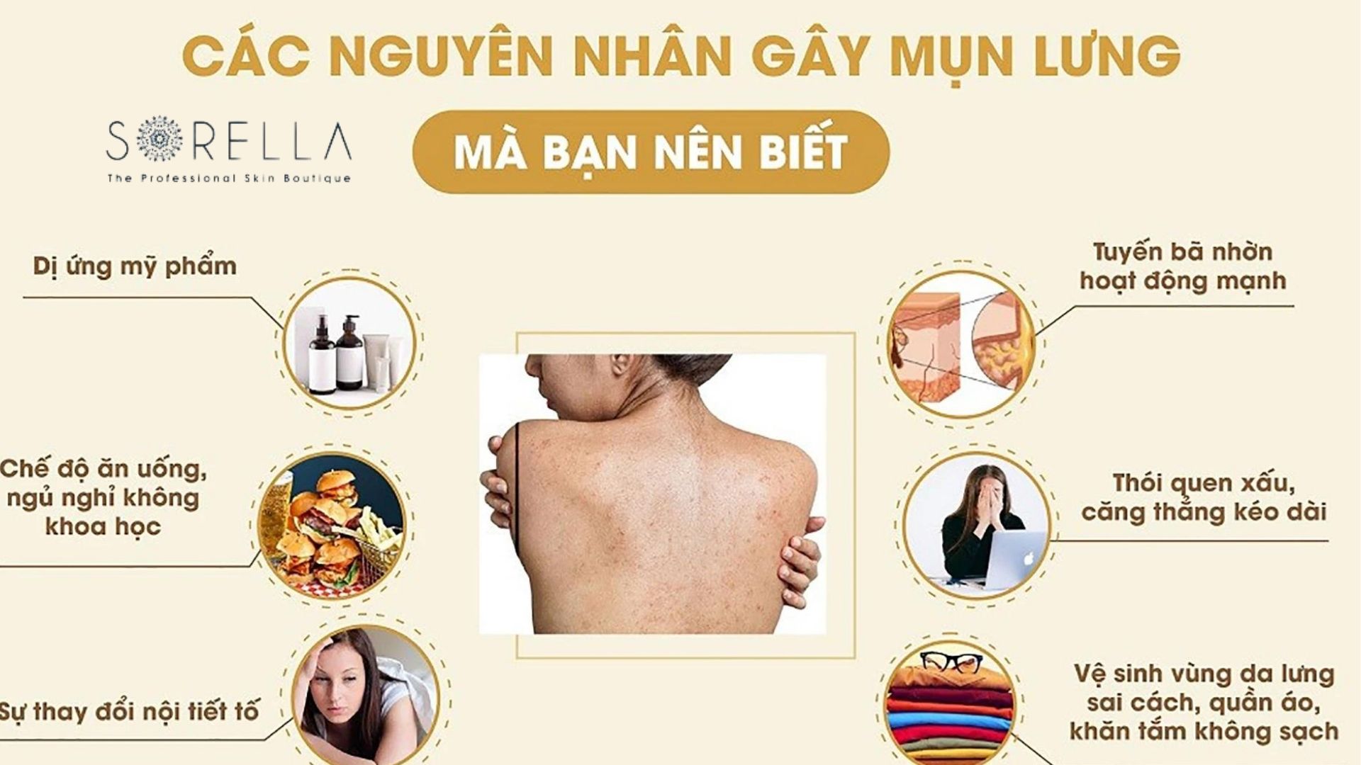8 nguyên nhân gây ra mụn lưng