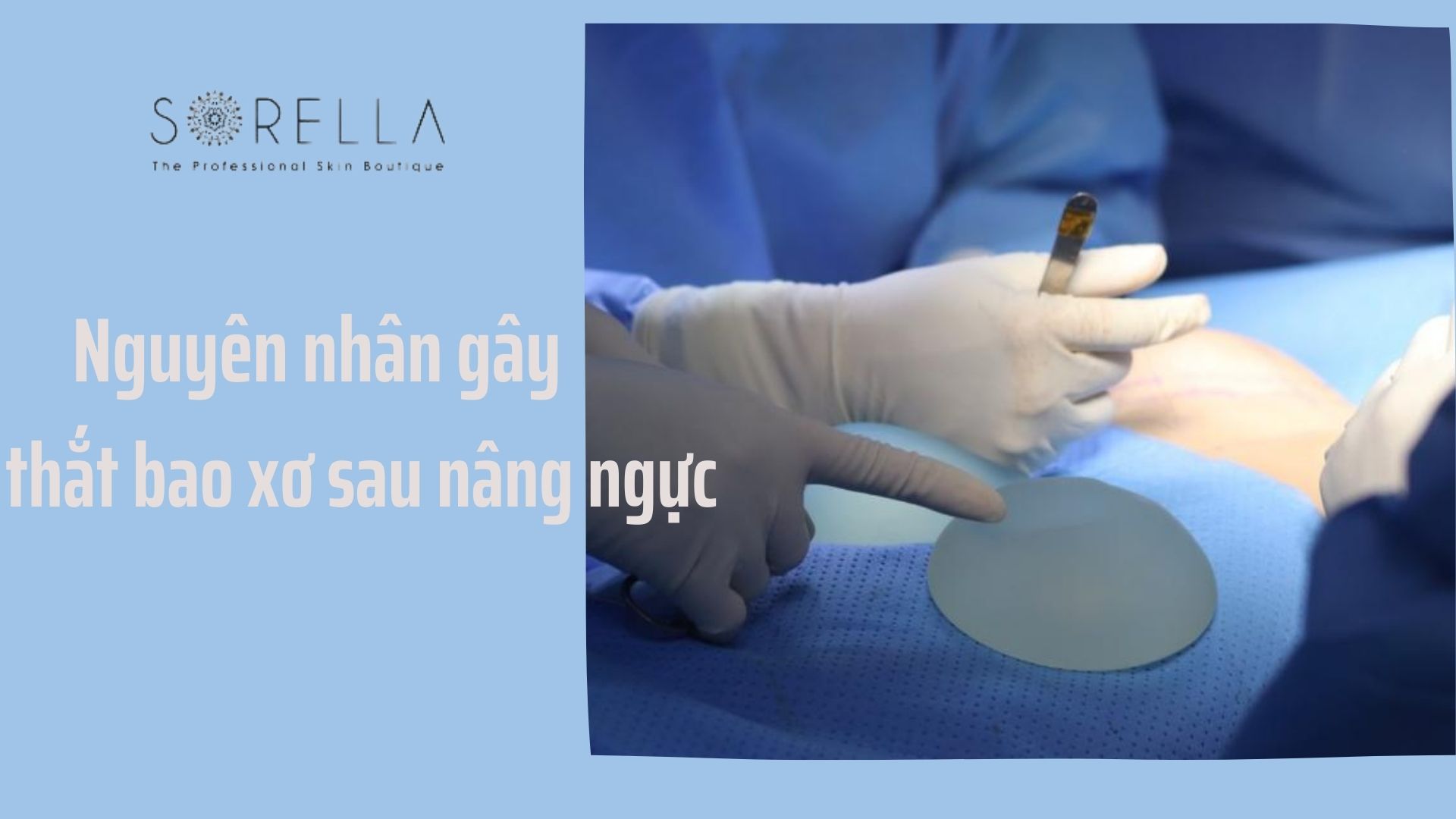 Cơ thắt bao xơ sau nâng ngực, 5 nguyên nhân và cách khắc phục