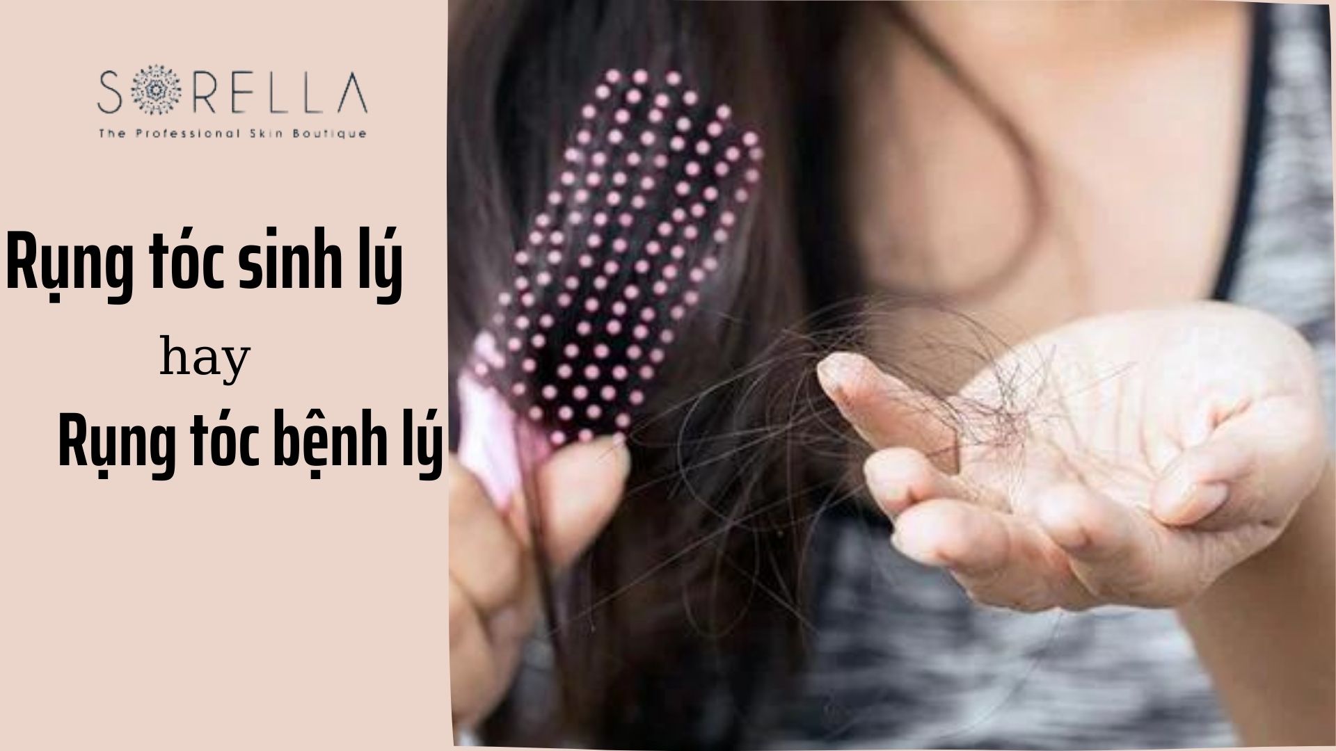 4 lý do nên tiêm meso điều trị rụng tóc