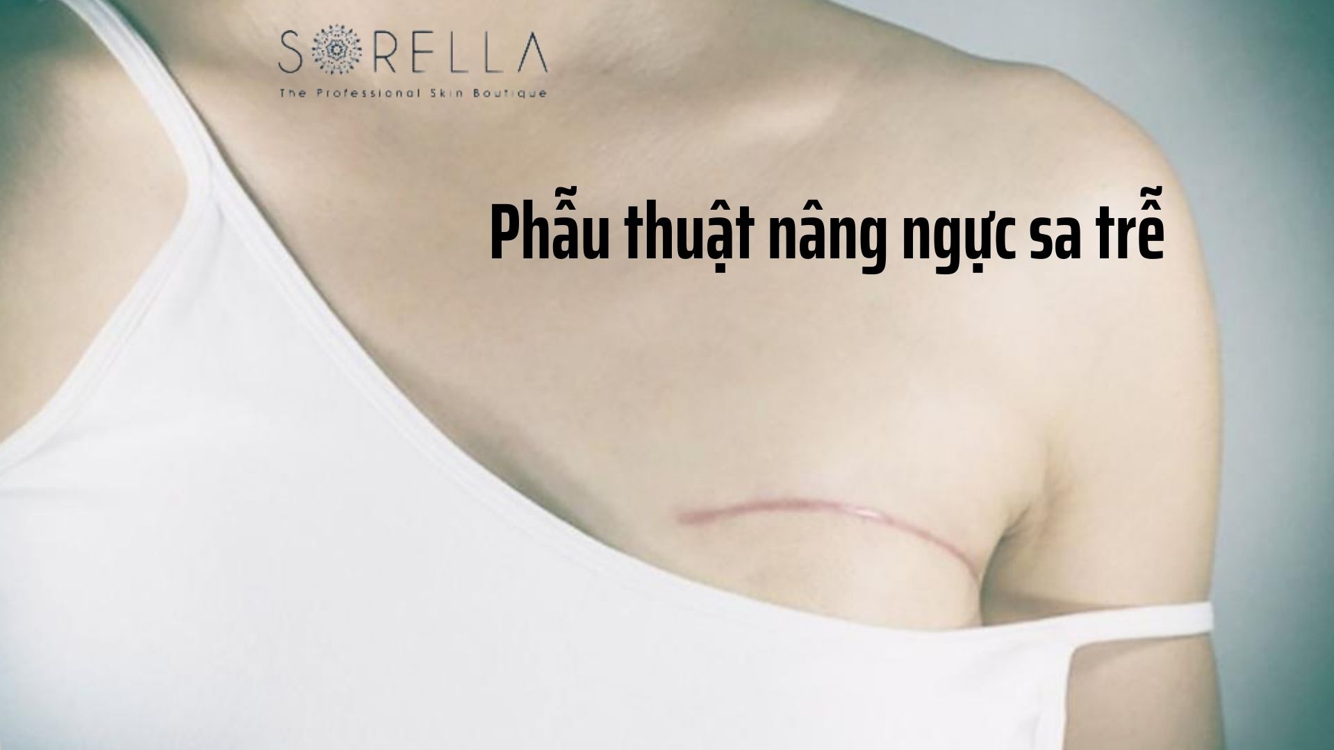 3 phương pháp nâng ngực chảy xệ hiệu quả