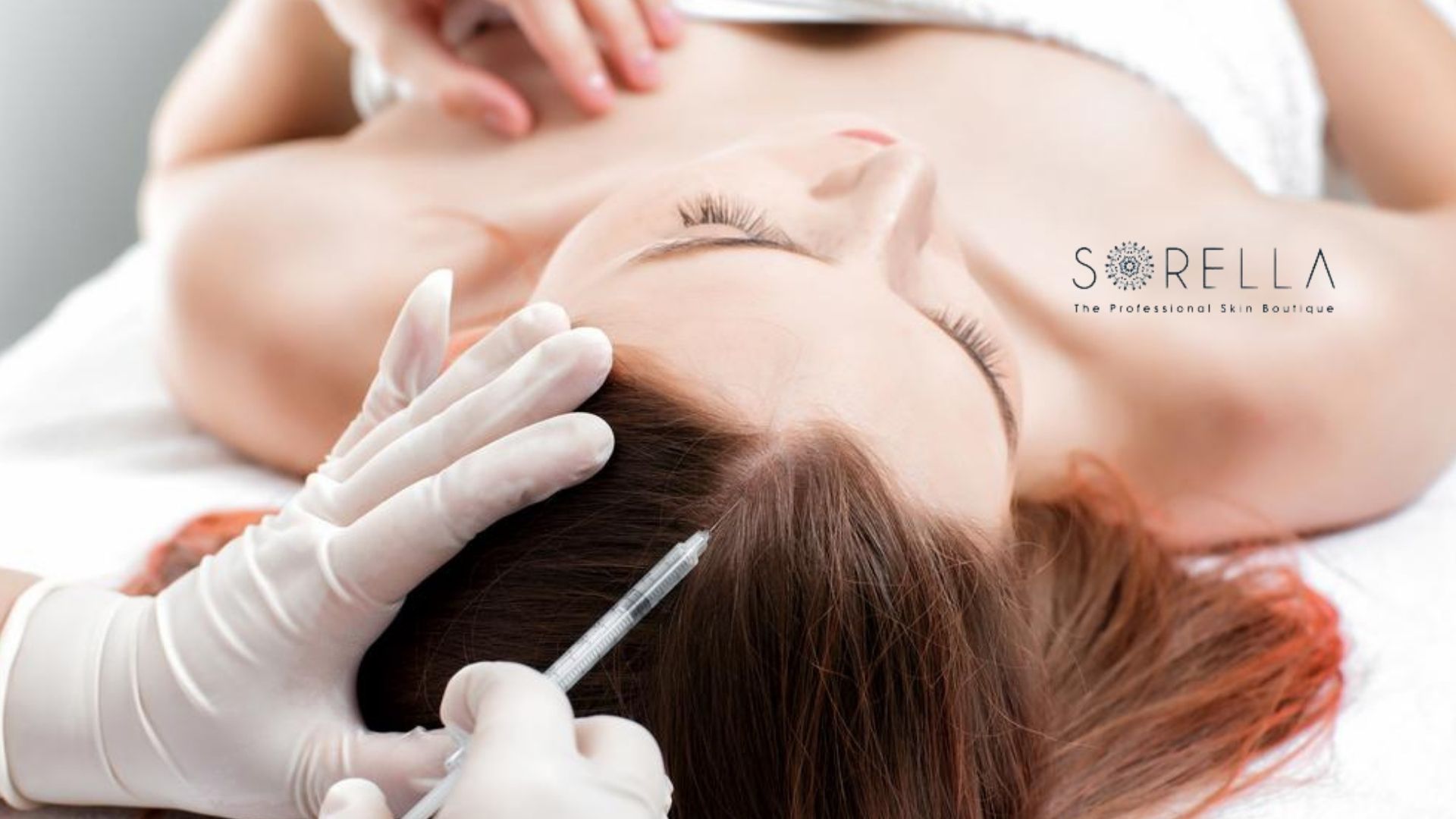 4 lý do nên tiêm meso điều trị rụng tóc