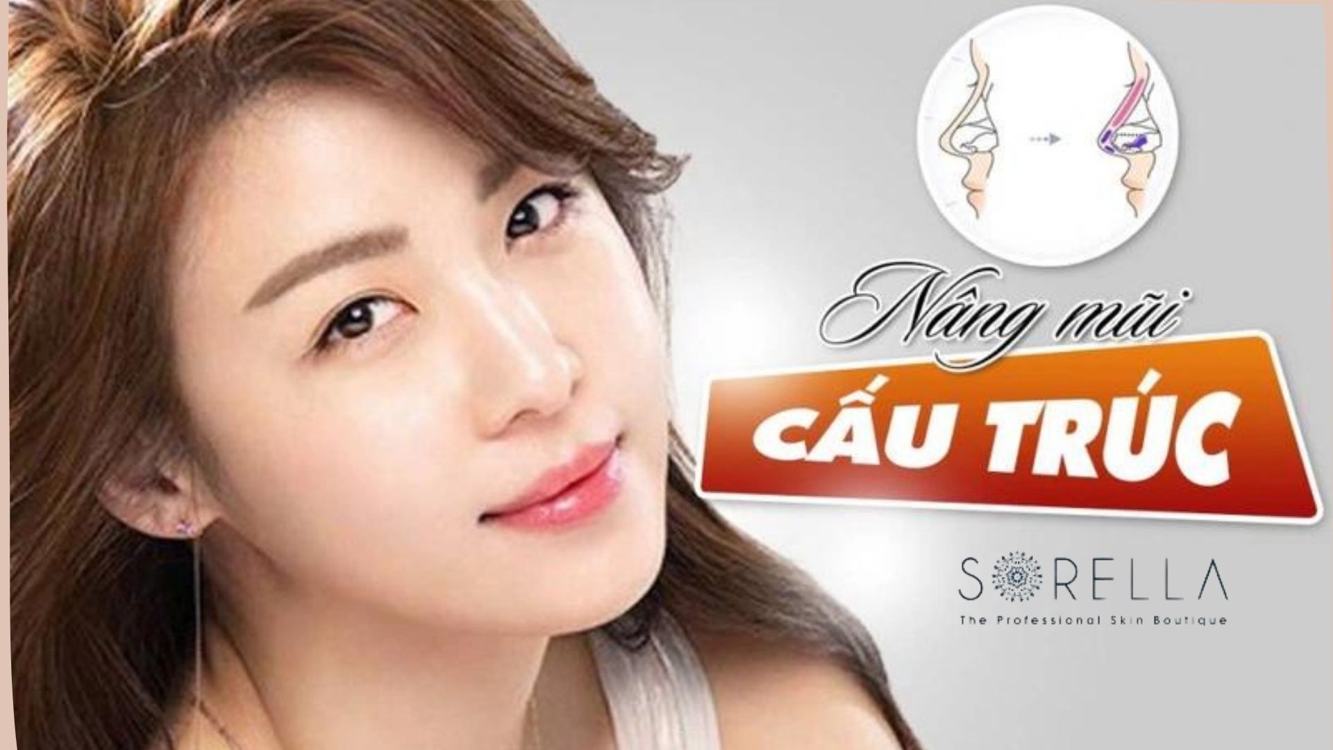 Nâng mũi cấu trúc và 3 loại sụn nâng mũi tốt nhất