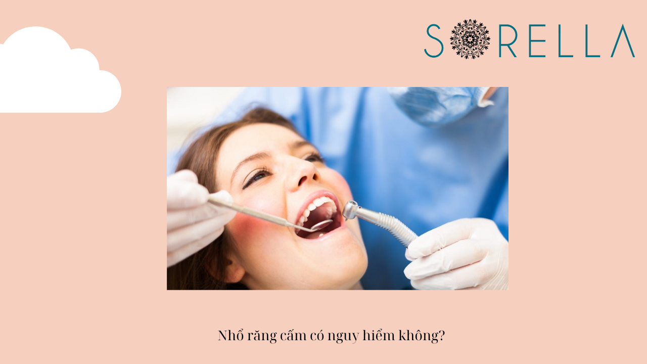 Nhổ răng cấm có nguy hiểm không?